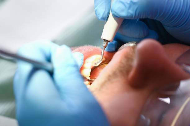 Best Urgent Dental Care  in Collinsville, MS