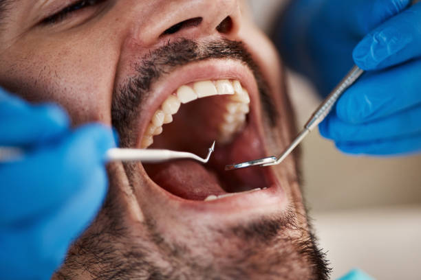 Best Tooth Pain Emergency Relief  in Collinsville, MS