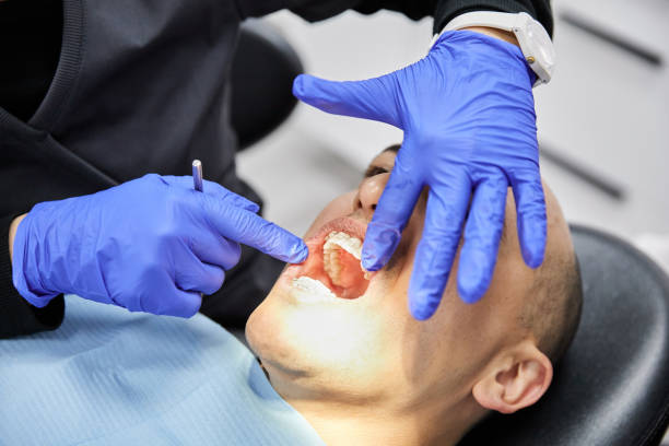 Dentist for Dental Trauma in MS